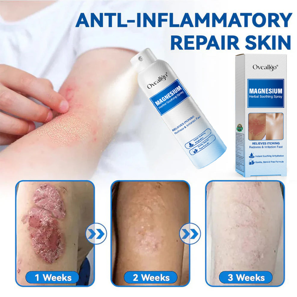Oveallgo® Magnesium PRO Herbal Psoriasis Spray