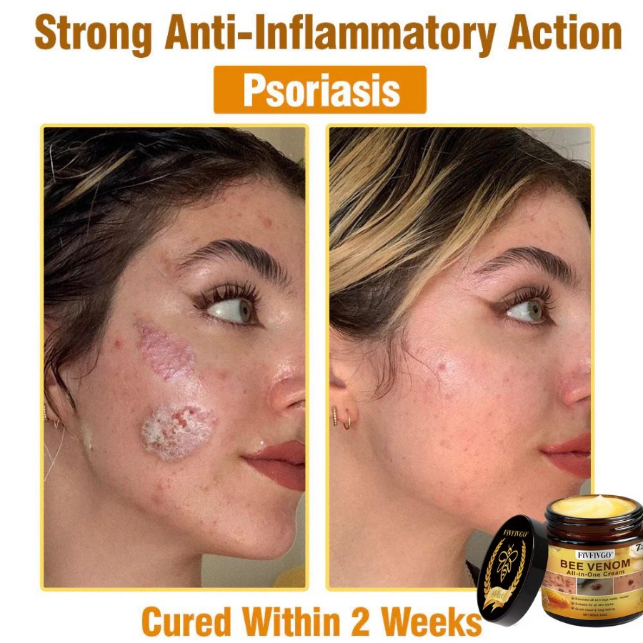 Fivfivgo® ULTRA Bee Venom All-In-One Cream