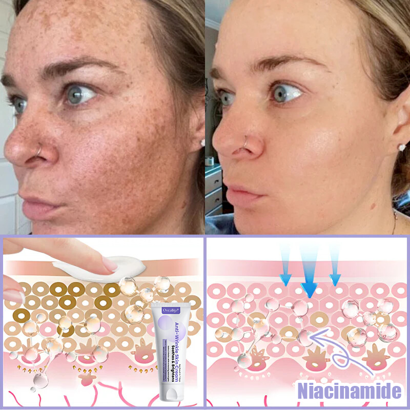 Oveallgo® Anti-Wrinkle Cream To Eliminate Wrinkles, Firm And Whiten The Skin - Last offer! 🔥90% discount