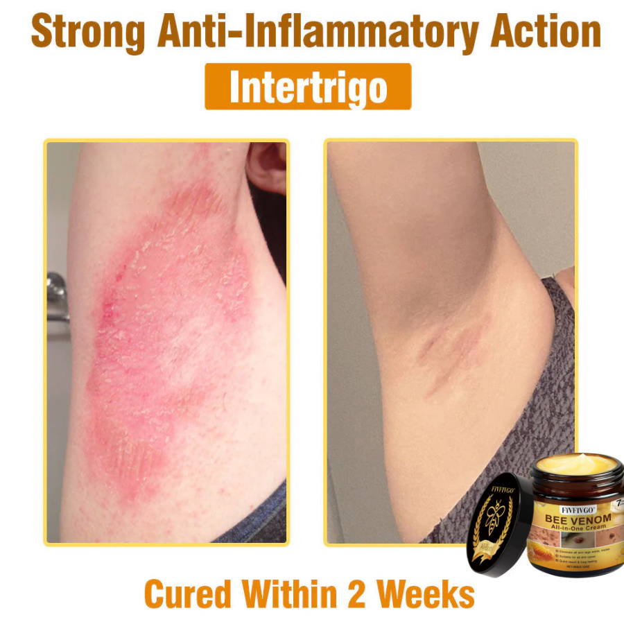 Fivfivgo® ULTRA Bee Venom All-In-One Cream