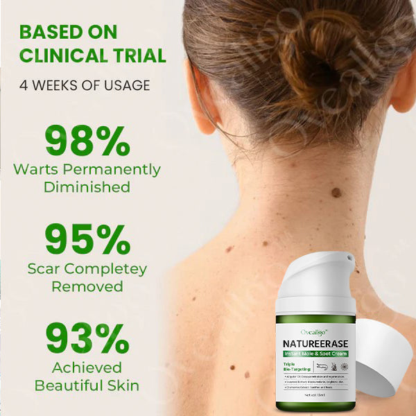 ✅ Official Store: Oveallgo® NatureErase MAX Instant Mole & Spot Cream