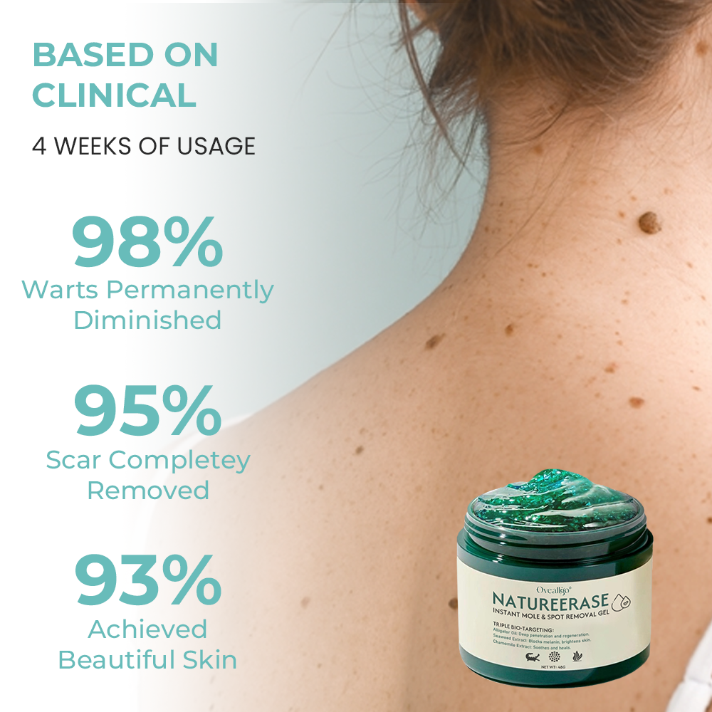 ✅ Official Store: Oveallgo® NatureErase Instant Mole & Spot Removal Gel