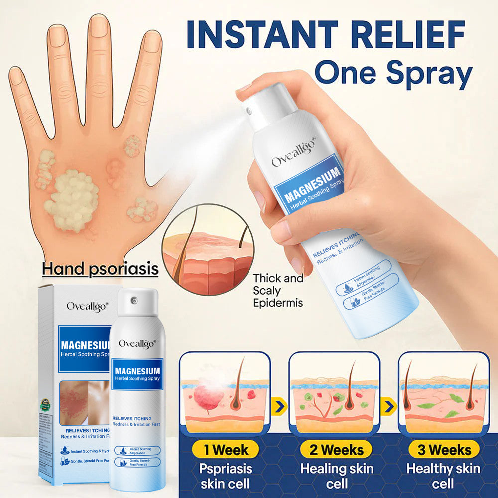 Oveallgo® Magnesium PRO Herbal Psoriasis Spray