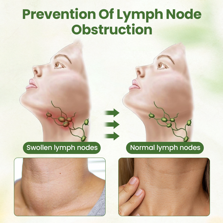 Oveallgo® Lymphatic PRO Detox Herbal Cream