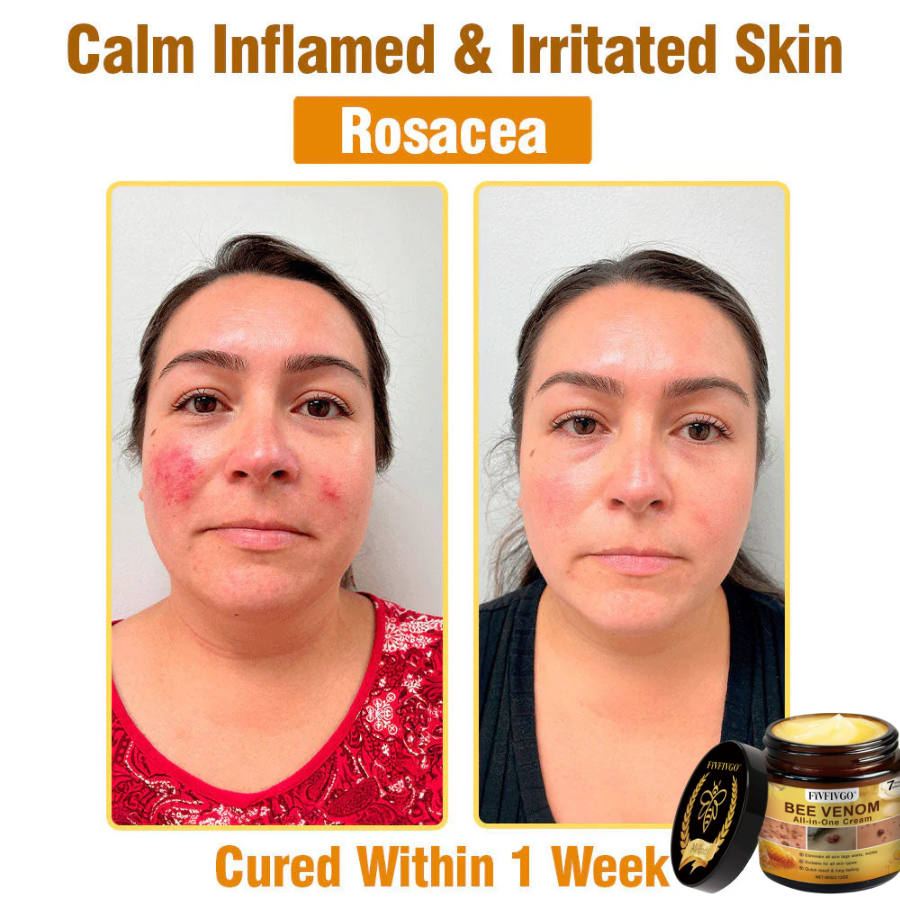 Fivfivgo® ULTRA Bee Venom All-In-One Cream