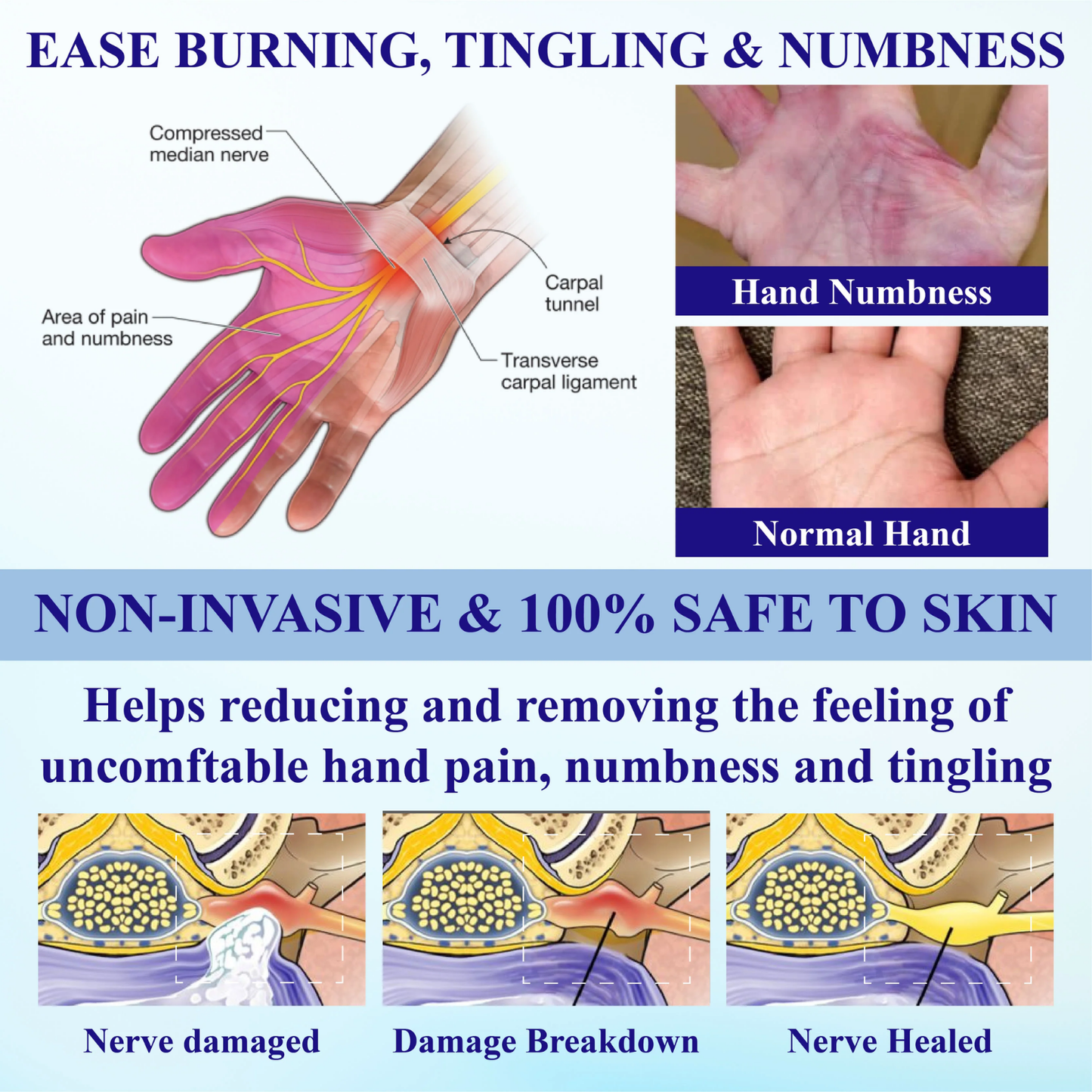 NovaRX® NumbAway PRO CoolEase Neuropathy Spray