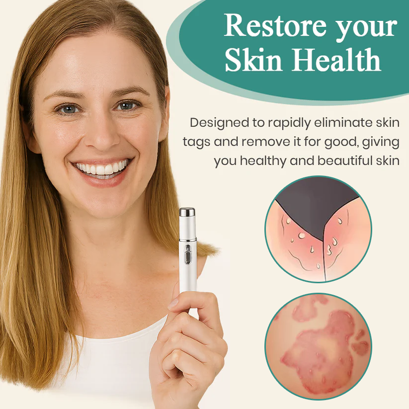 Bikenda® HPV Genital Warts Removal Laser Pen