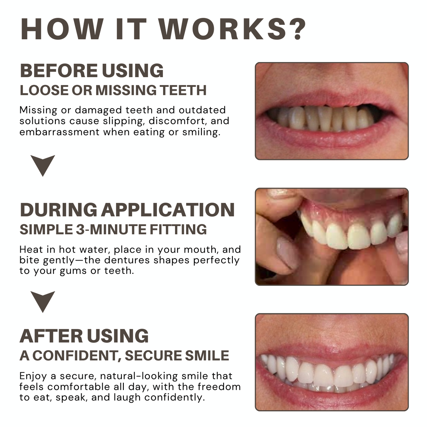 Bikenda® ULTRA Custom-Fit Full Denture Set