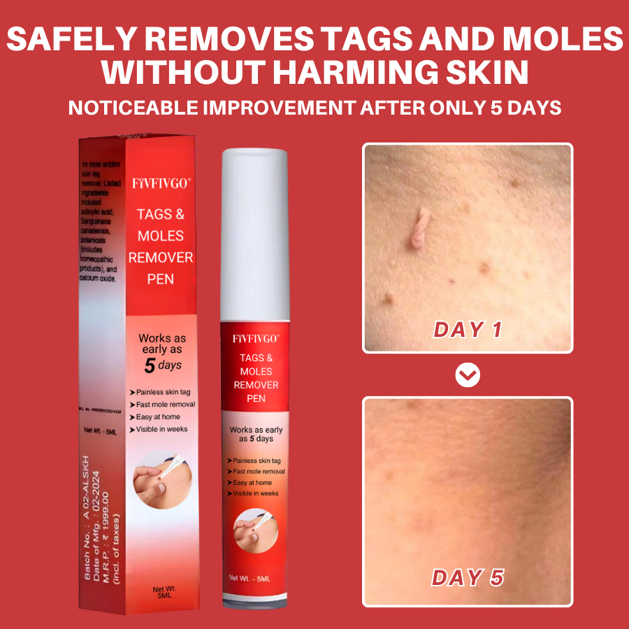 Fivfivgo® PRO Tags & Moles Remover Pen