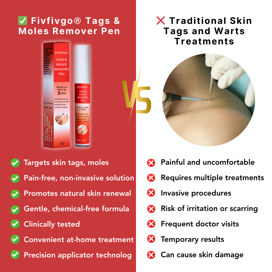 Fivfivgo® PRO Tags & Moles Remover Pen