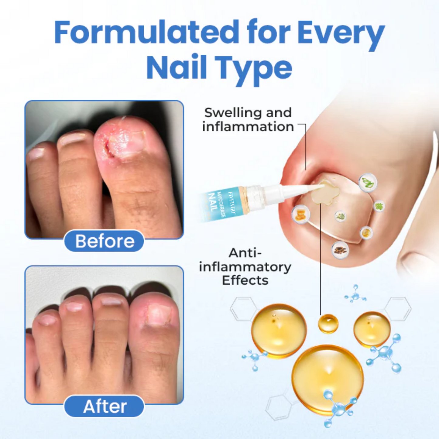 Fivfivgo® MycoErase PRO Nail Revive Pen