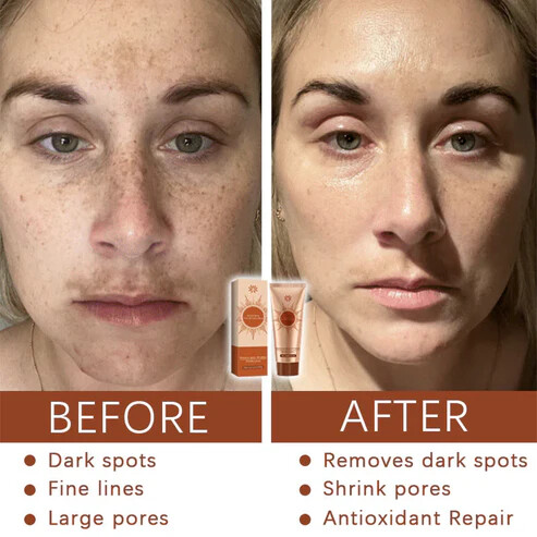 Fivfivgo® PRO Herbal Spots Peel-Off Facial Mask
