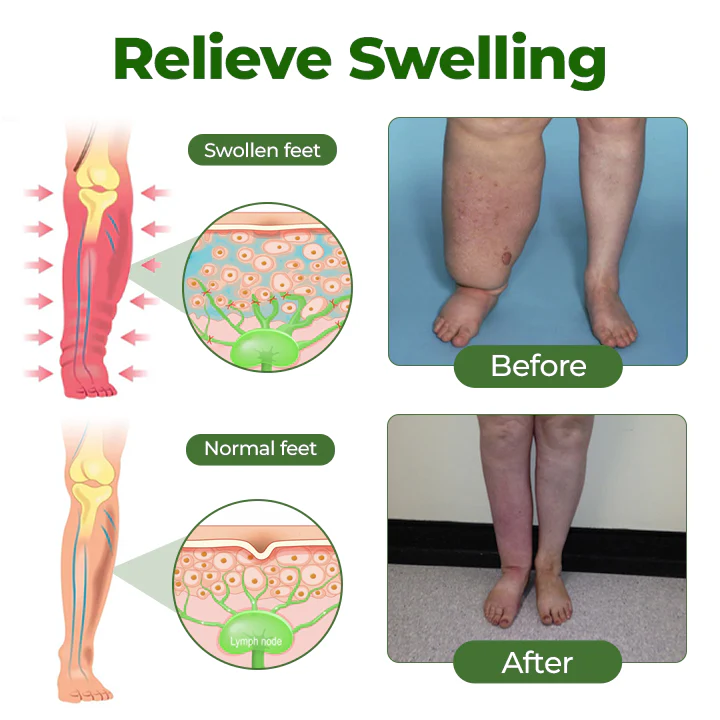 NovaRX® FluidEase ULTRA Leg Therapy Edema Cream