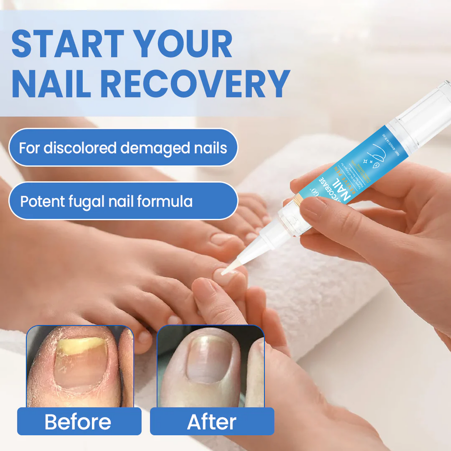 Fivfivgo® MycoErase PRO Nail Revive Pen