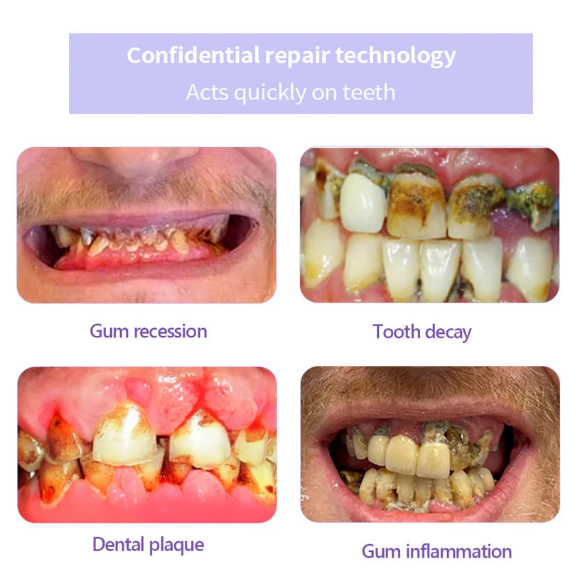 Fivfivgo® ULTRA Teeth Restoration Mineral Powder