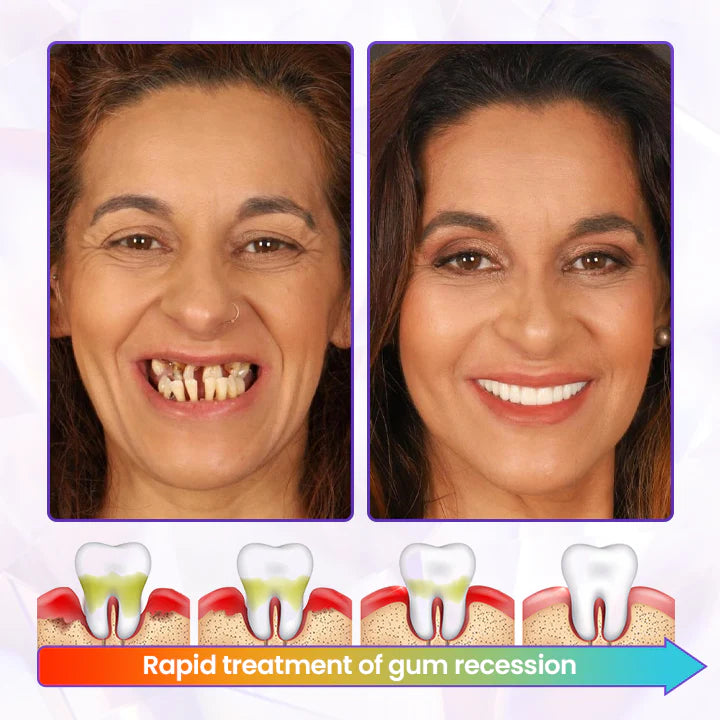 Oveallgo® BeeRenew Advanced Gum Healing Toothpaste