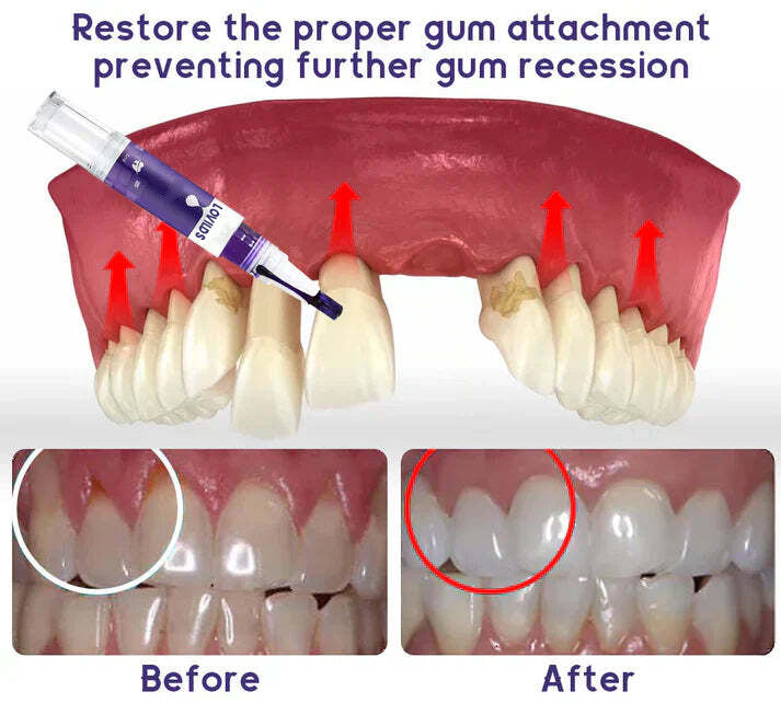 Oveallgo® ULTRA Gum Care Gel – Restore & Strengthen Your Gums
