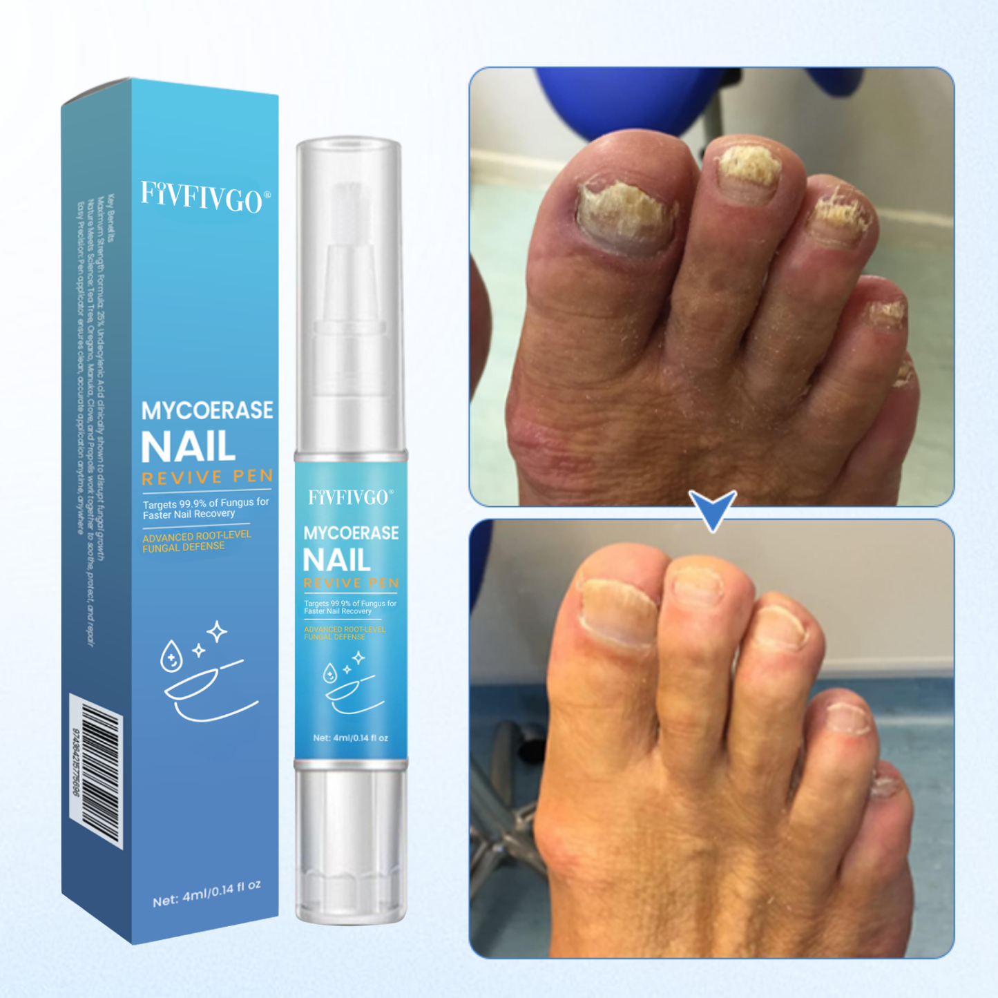 Fivfivgo® MycoErase PRO Nail Revive Pen