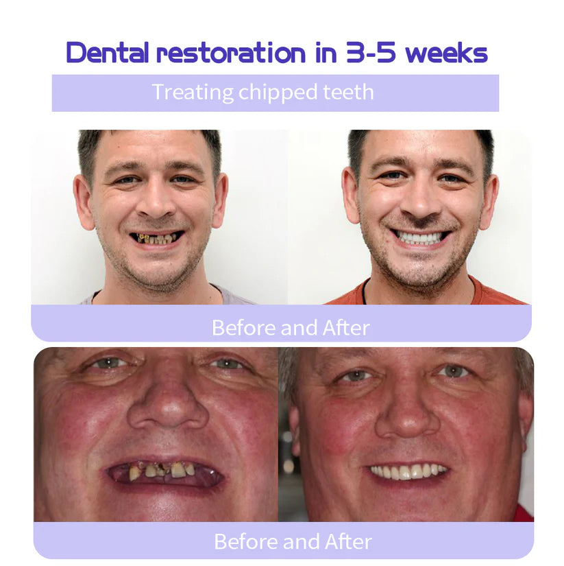 Fivfivgo® ULTRA Teeth Restoration Mineral Powder
