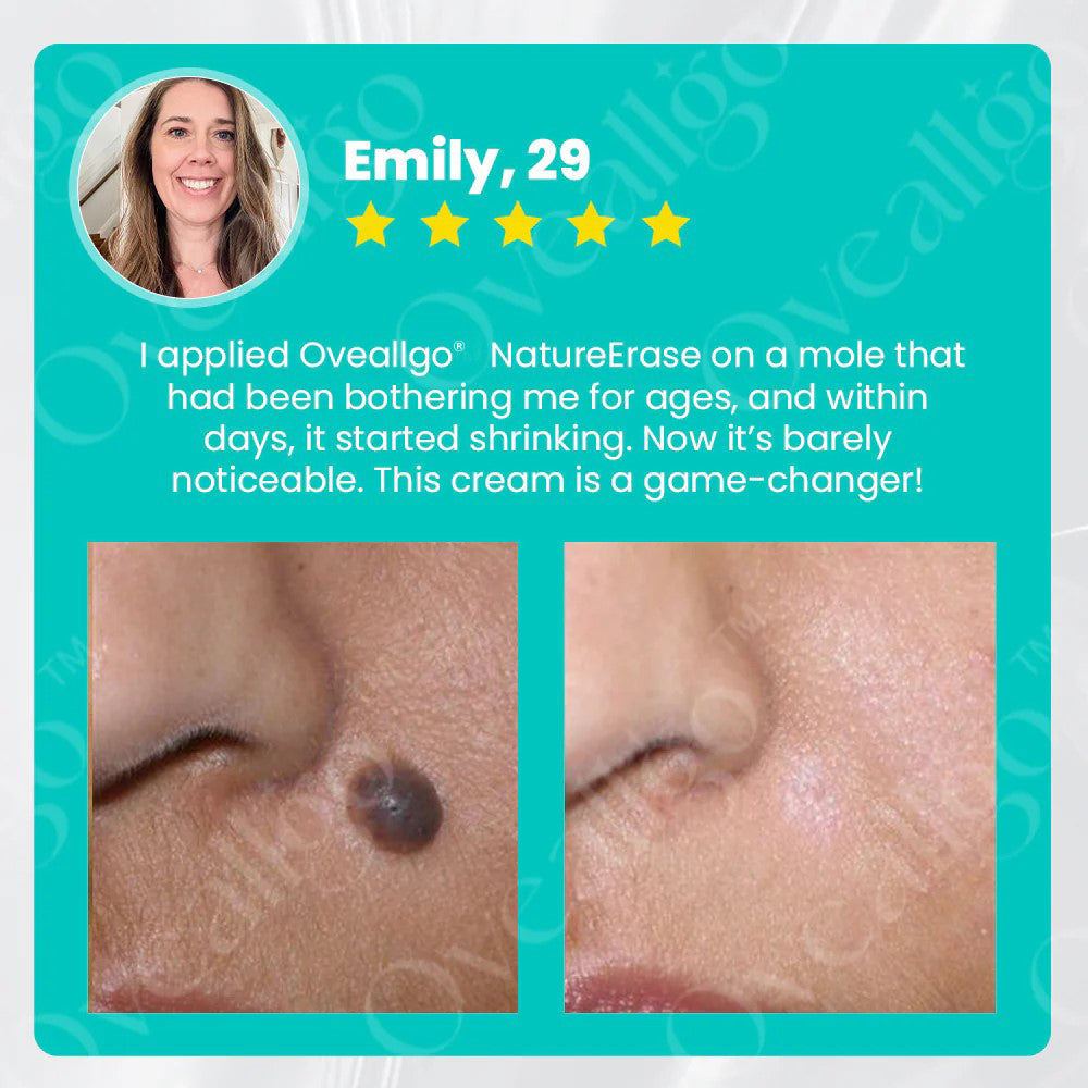 ✅ Official Store: Oveallgo® NatureErase Pro Instant Alligator Oil Mole & Spot Removal Gel