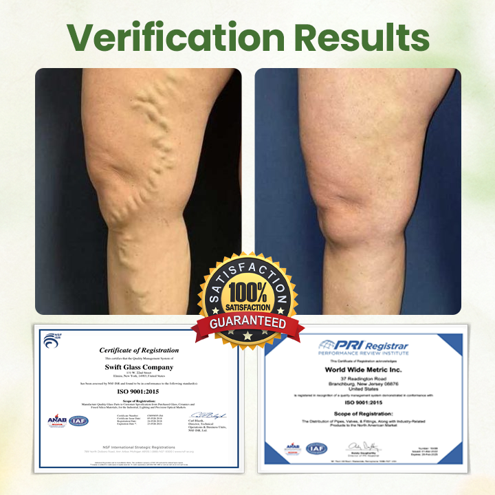 Oveallgo® Lymphatic PRO Detox Herbal Cream