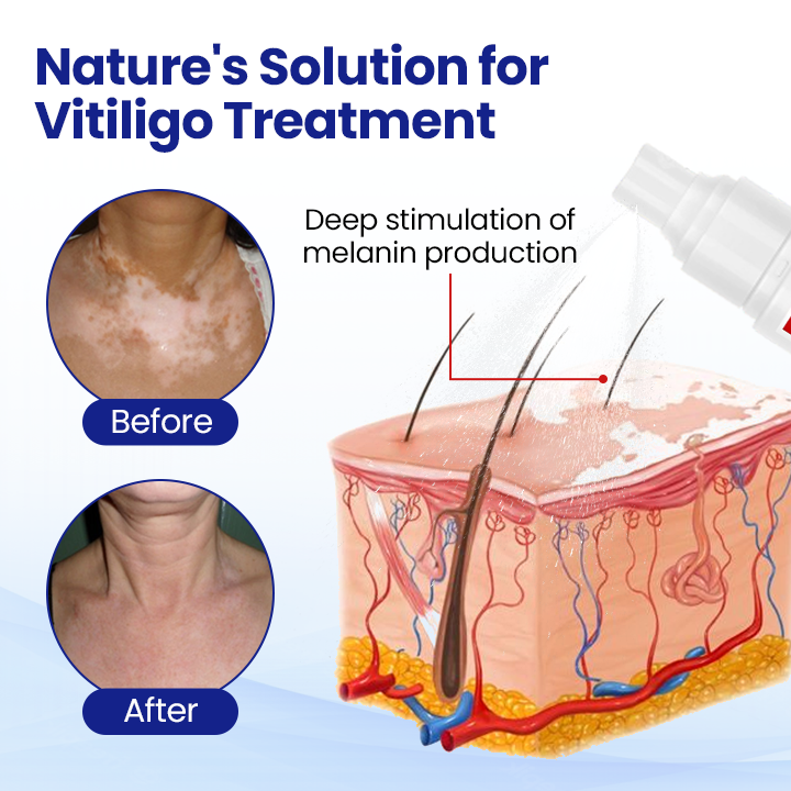 Fivfivgo® ULTRA VitiClear Herbal Spray