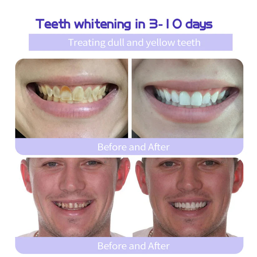 Fivfivgo® ULTRA Teeth Restoration Mineral Powder