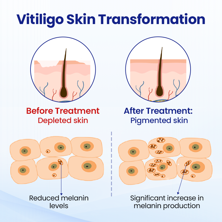 Oveallgo® Evenora Herbal Spray Pro