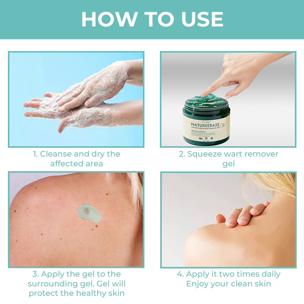 ✅ Official Store: Oveallgo® NatureErase Instant Mole & Spot Removal Gel
