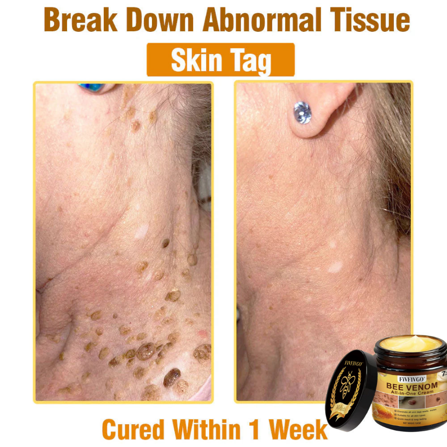 Fivfivgo® ULTRA Bee Venom All-In-One Cream