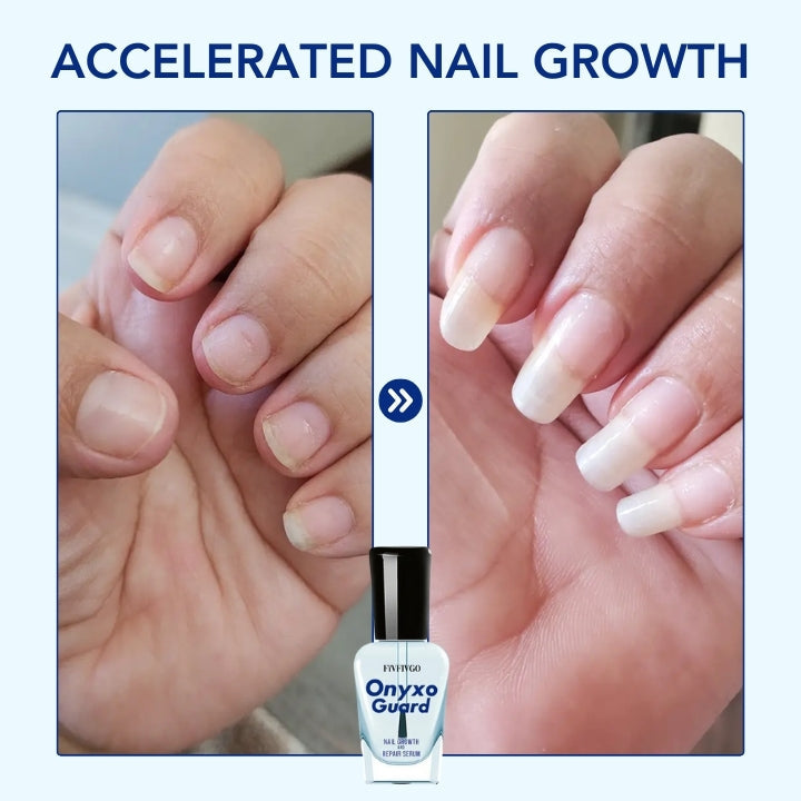 Fivfivgo® OnyxoGuard ULTRA Nail Growth and Repair Serum