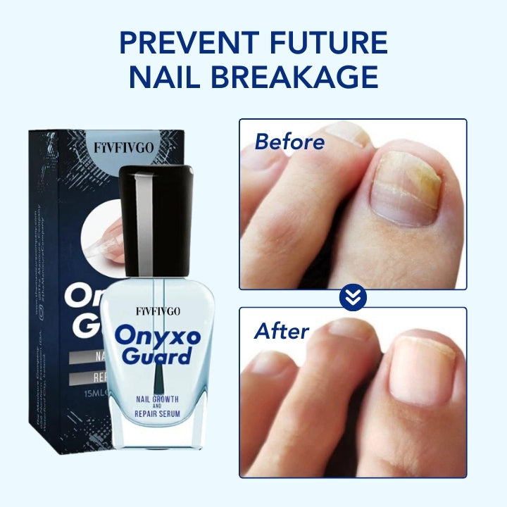 Fivfivgo® OnyxoGuard ULTRA Nail Growth and Repair Serum