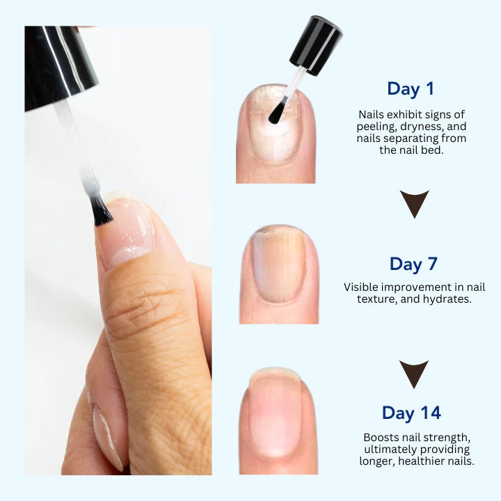 Fivfivgo® OnyxoGuard ULTRA Nail Growth and Repair Serum