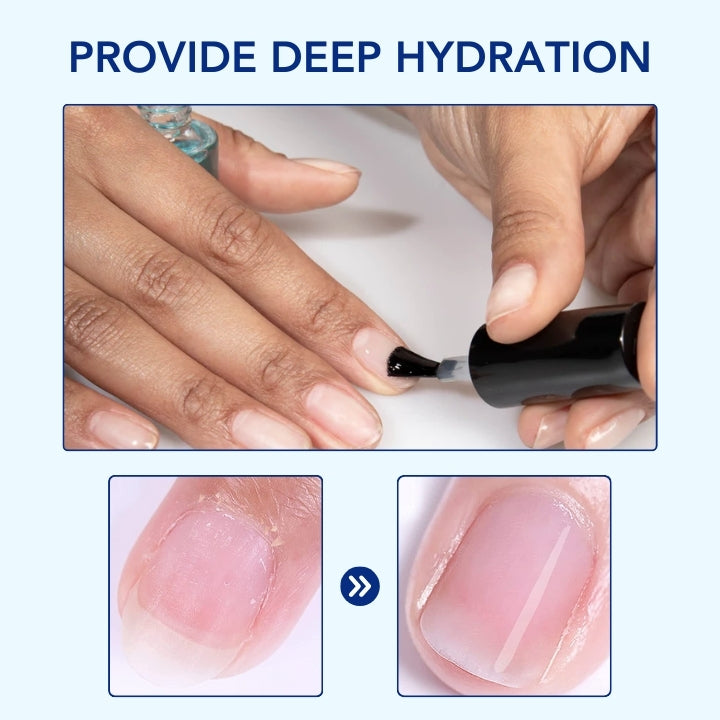 Fivfivgo® OnyxoGuard ULTRA Nail Growth and Repair Serum