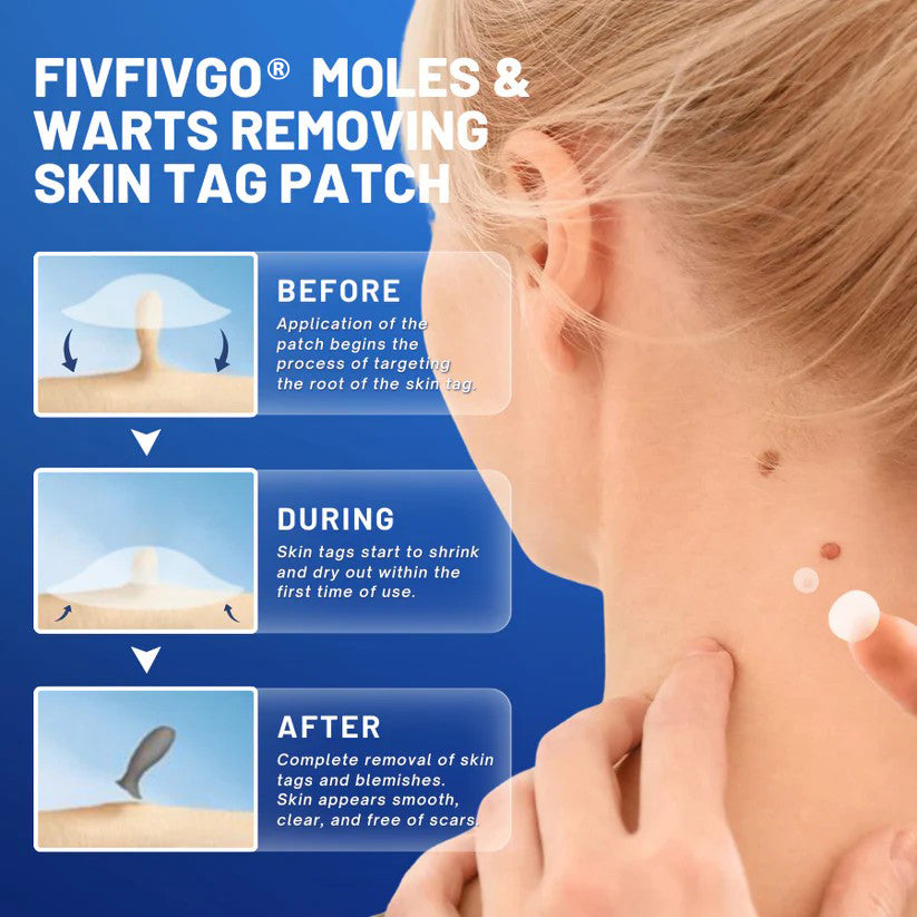 Fivfivgo® Advanced Moles & Warts Removing Skin Tag Patch