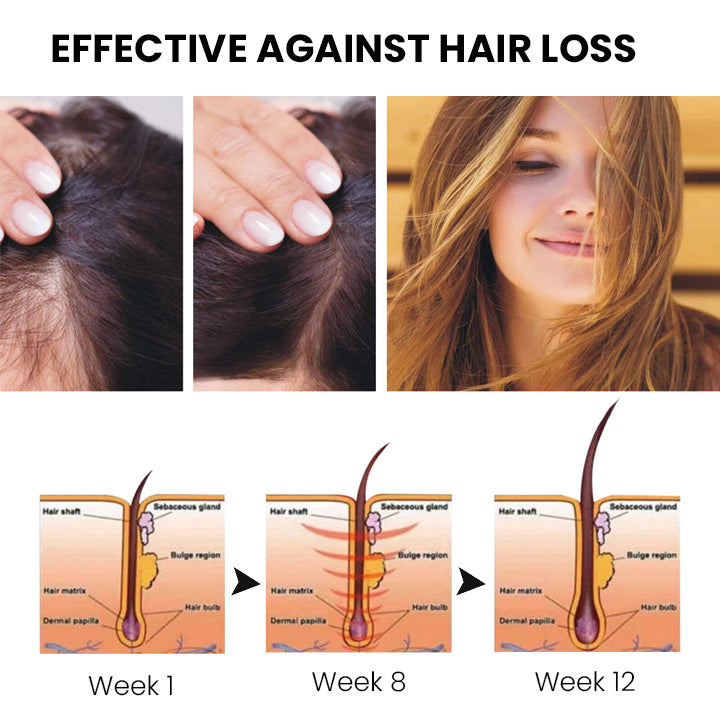 ✅Official Store: Oveallgo™ New ShougaGRO Japanese Hair Growth Spray👨⚕️Endorsed by AHLA (Clinically proven to promote hair regrowth, strengthen follicles, improve scalp health, and combat hair thinning)