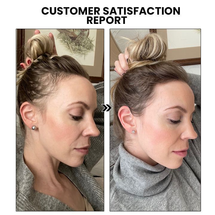 ✅Official Store: Oveallgo™ New ShougaGRO Japanese Hair Growth Spray👨⚕️Endorsed by AHLA (Clinically proven to promote hair regrowth, strengthen follicles, improve scalp health, and combat hair thinning)