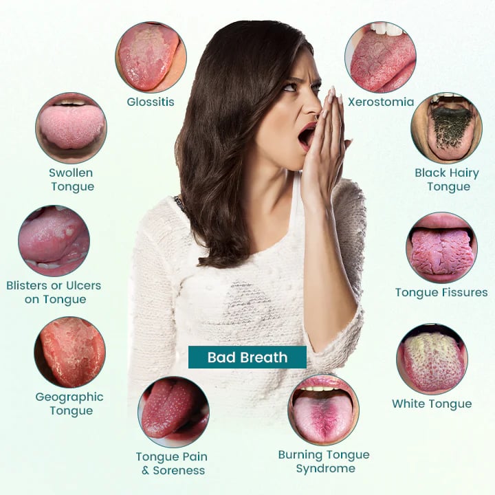 Oveallgo® GlosShield ACTIVE Tongue Repair Spray