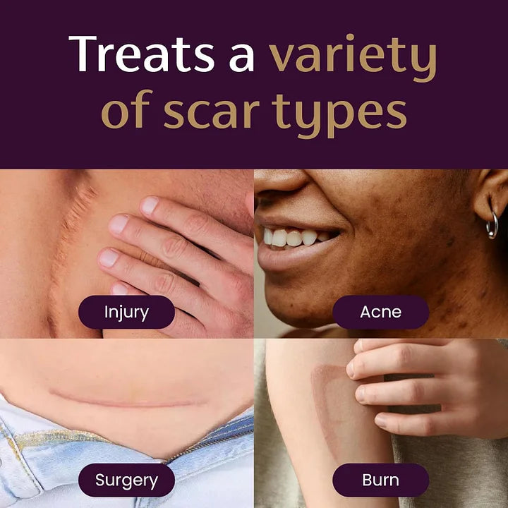 Oveallgo® Advanced Scar Gel Improve The Appearance Of Scars And Stretch Marks