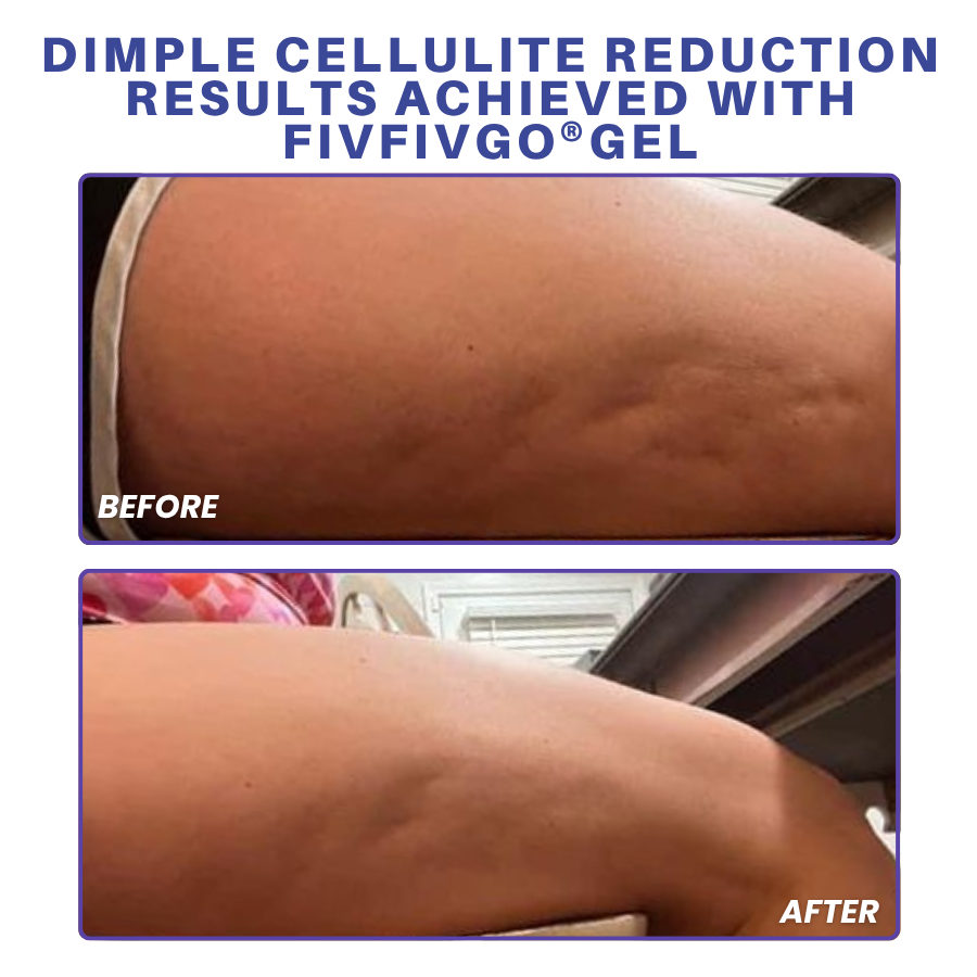 Fivfivgo® PDRN-GLP-1 Cellulite Targeting Reedle Shot Gel
