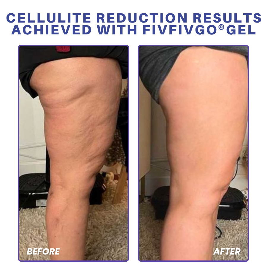 Fivfivgo® PDRN-GLP-1 Cellulite Targeting Reedle Shot Gel