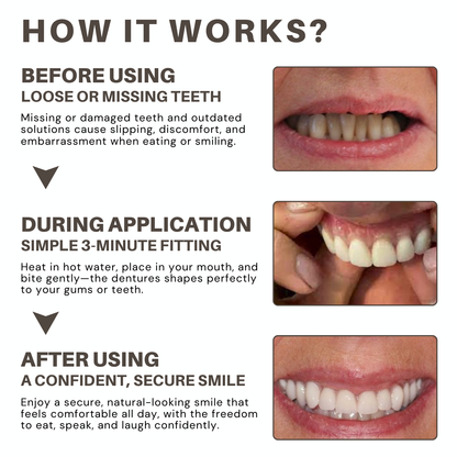 Bikenda® ULTRA Custom-Fit Full Denture Set