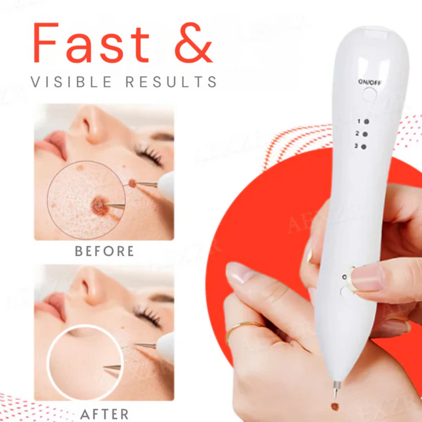 Bikenda® Portable ULTRA Skin Care Laser Pen