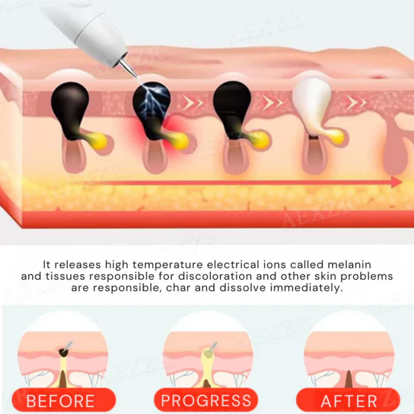Bikenda® Portable ULTRA Skin Care Laser Pen