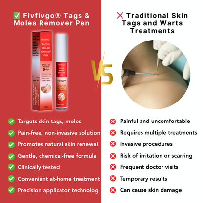 Fivfivgo® PRO Tags & Moles Remover Pen