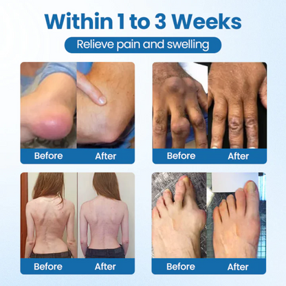 NovaRX® BPC-157 ULTRA Joint Repair Cream