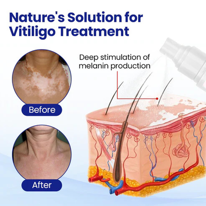 Oveallgo® Evenora Herbal Spray