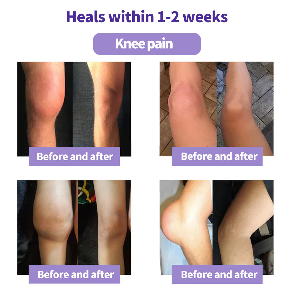 Oveallgo® Turmeric & Emu Oil Arthritis Soothing Pain Relief Therapy Gel