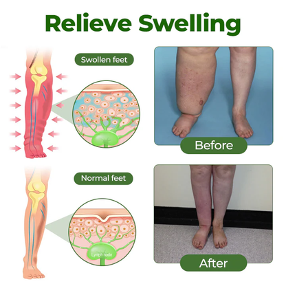 NovaRX®  ULTRA FluidEase Leg Therapy Edema Cream