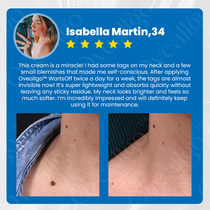 ✅ Official Store: Oveallgo™ WartsOff Professional Instant Blemish Removal Cream👩‍⚕️USA Dermatology Association (AADA）Approved (Skin Tags, Warts, Dark Spots Removal)